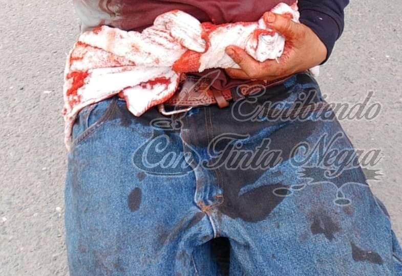 BALEAN A JOVEN; MURIÓ EN EL HOSPITAL