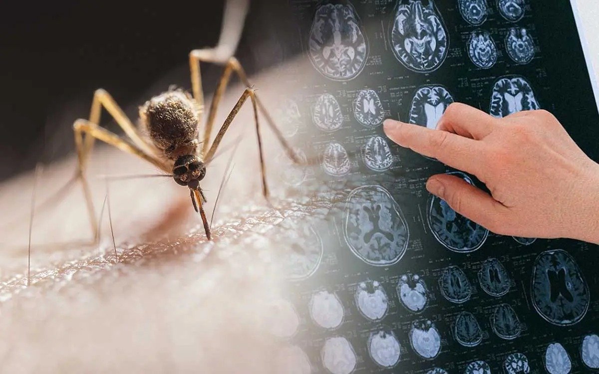 CONFIRMAN EL PRIMER CASO DE ENCEFALITIS EQUINA EN UNA PERSONA