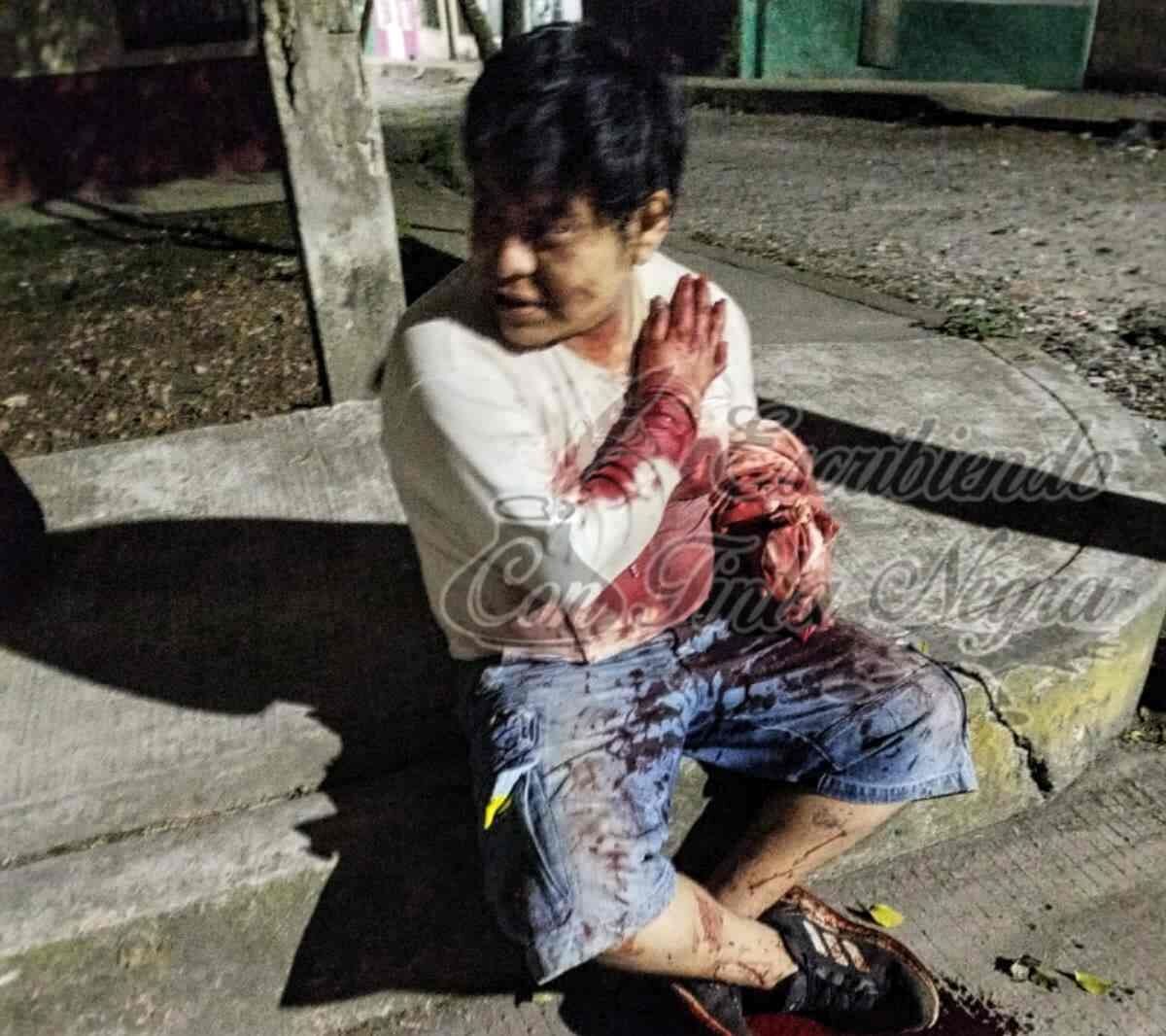 LO MACHETEA SU TÍO EN HUATUSCO