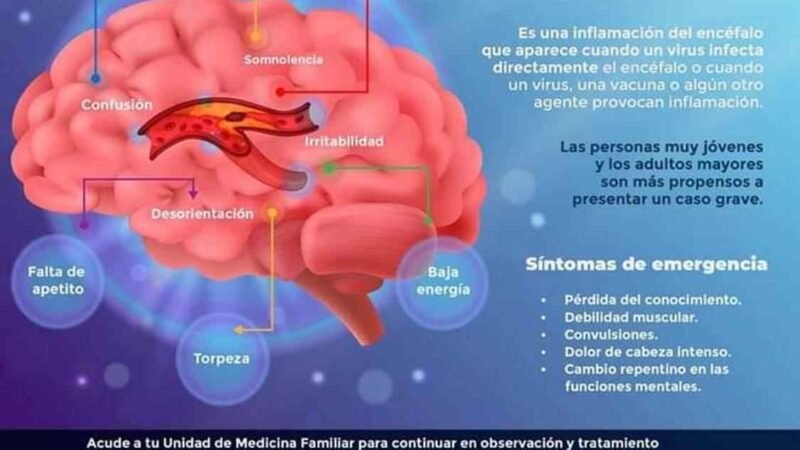 INFORMA IMSS SOBRE SÍNTOMAS Y CAUSAS DE ENCEFALITIS