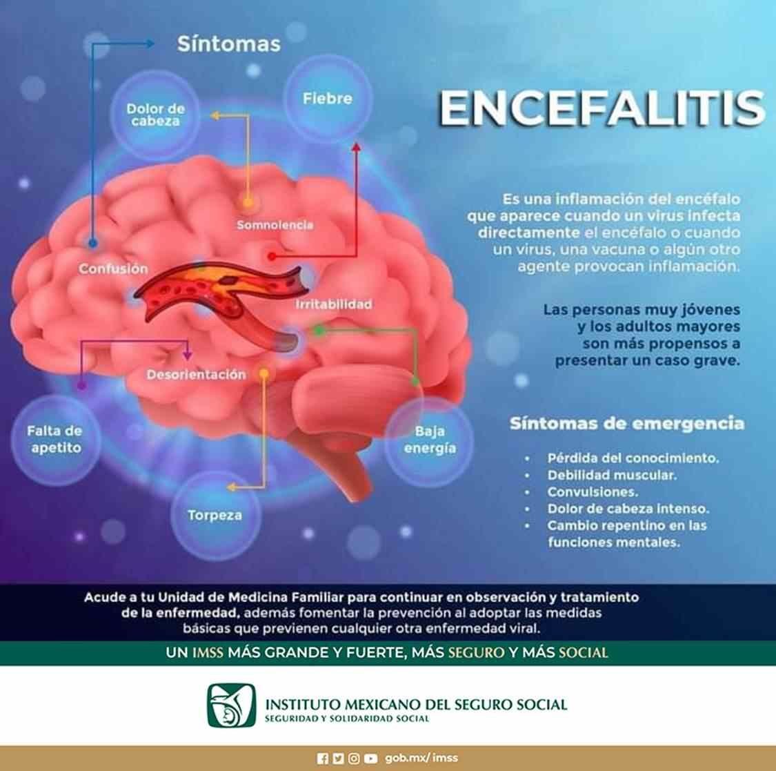 INFORMA IMSS SOBRE SÍNTOMAS Y CAUSAS DE ENCEFALITIS