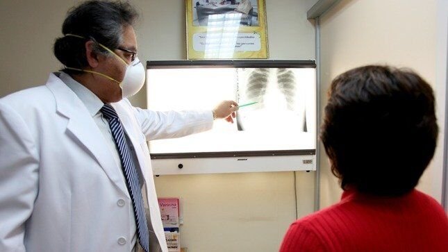 EN MÉXICO SUMAN 5 MIL CASOS DE TUBERCULOSIS EN LO QUE VA DE 2024