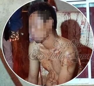INTENTA AGREDIR A SUS PADRES Y LO MACHETEAN