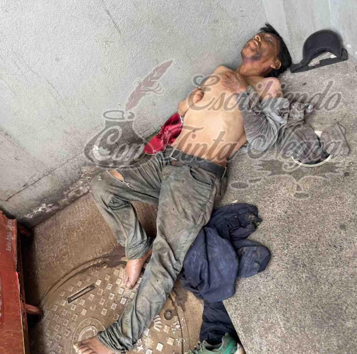 MUERE EN LA VÍA PÚBLICA