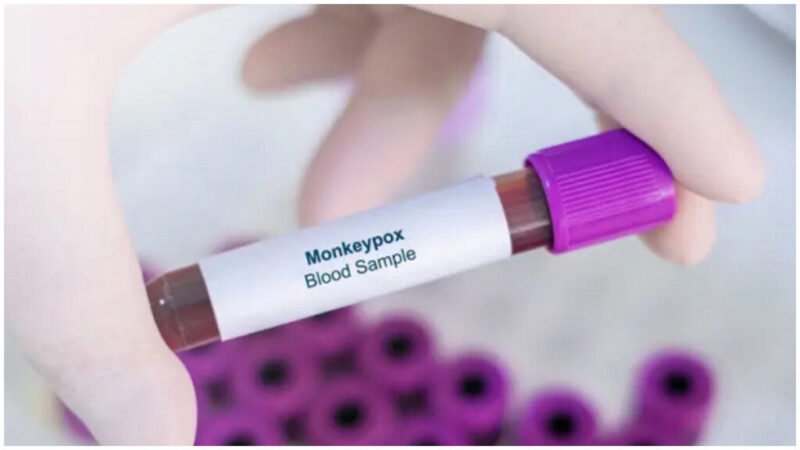 SECRETARÍA DE SALUD EMITE RECOMENDACIONES SOBRE EL MPOX