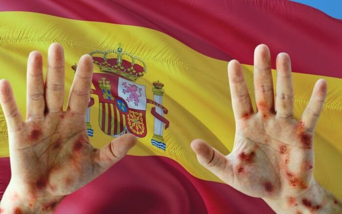 ESPAÑA, EL PAÍS CON MÁS INCIDENCIA DE MPOX CON 8,104 CASOS