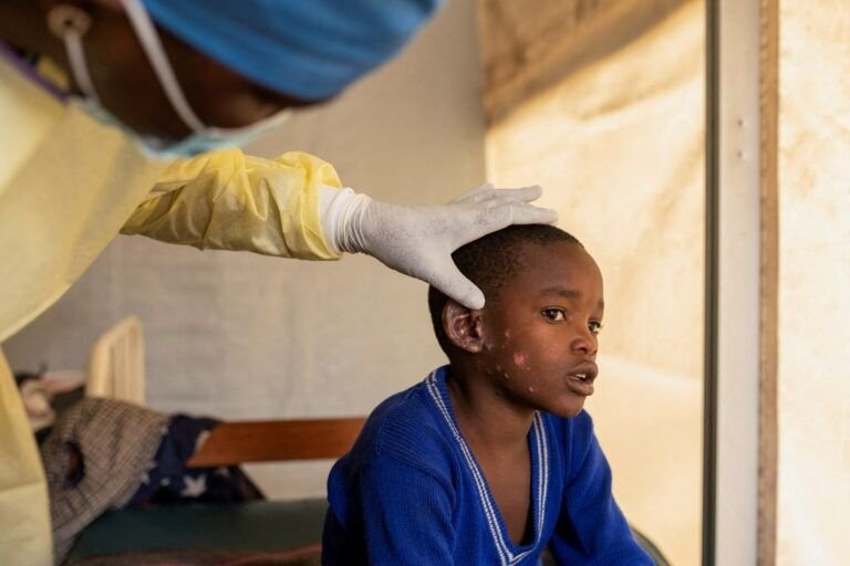 PIDEN MÁS CONTROLES SANITARIOS TRAS EL PRIMER CASO DE MPOX EN EUROPA