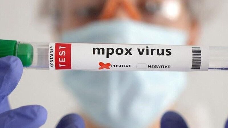 MÉXICO BUSCA ACELERAR EL PROCESO PARA APLICAR VACUNA CONTRA VIRUELA DE MONO