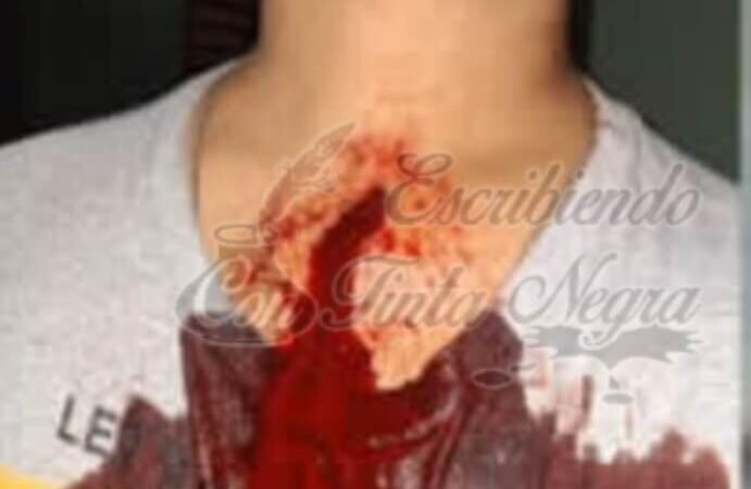 ASALTA Y APUÑALA A JOVEN; LO DETIENE LA POLICÍA