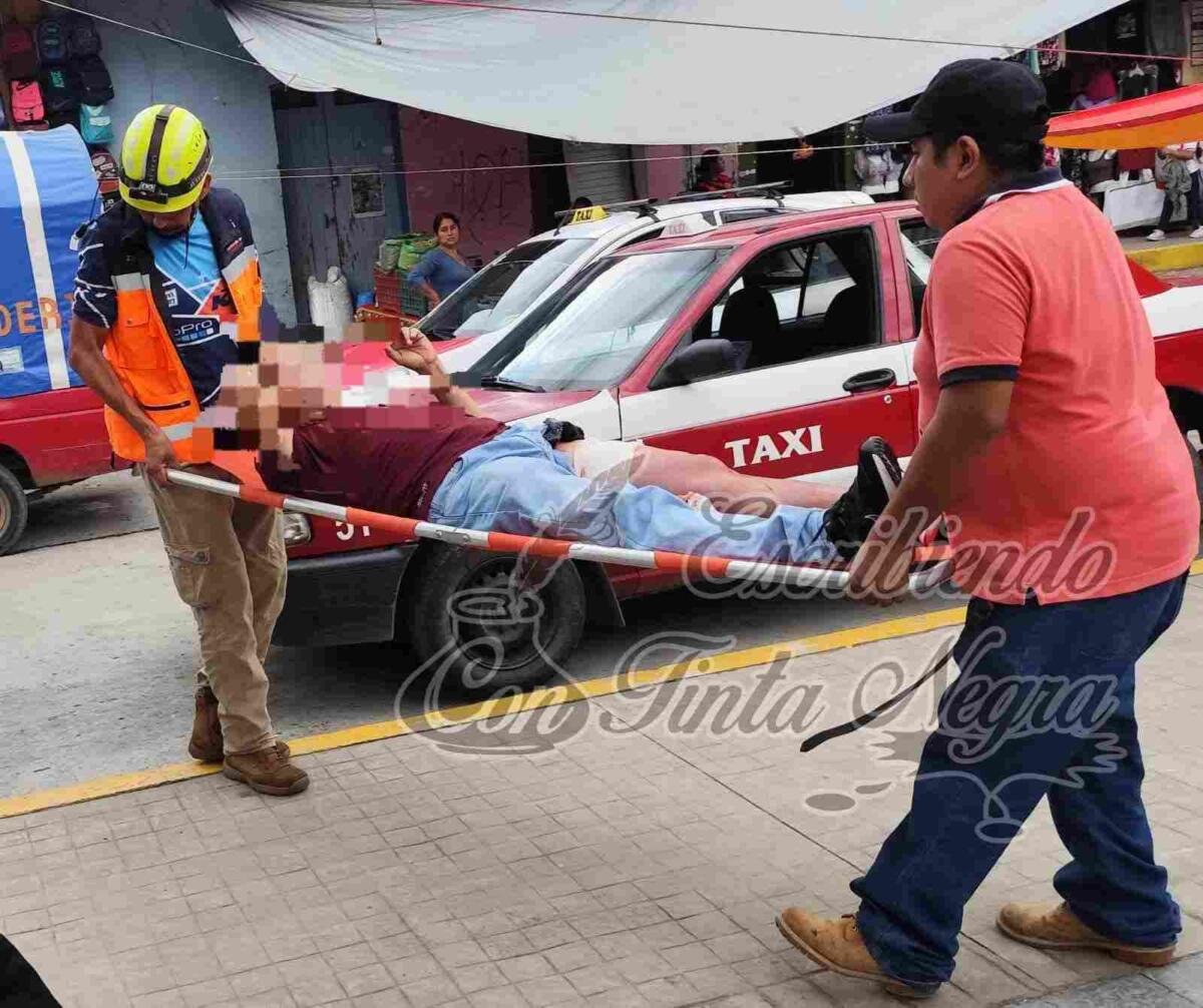 LO APUÑALAN EN INTENTO DE ASALTO