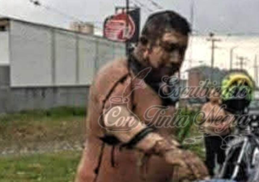 GRAVE, HOMBRE LESIONADO POR EXPLOSIÓN DE POLVORÍN