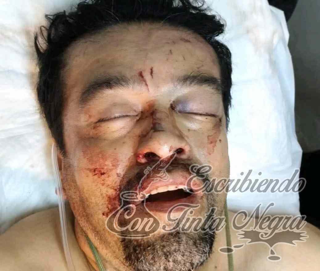MUERE TRAS DERRAPAR EN LA RAYA