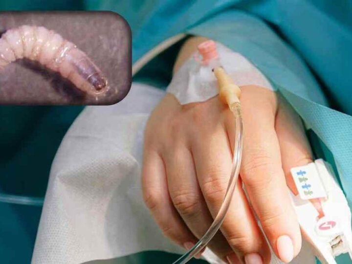 DETECTAN PERSONA INFECTADA POR GUSANO BARRENADOR EN YUCATÁN