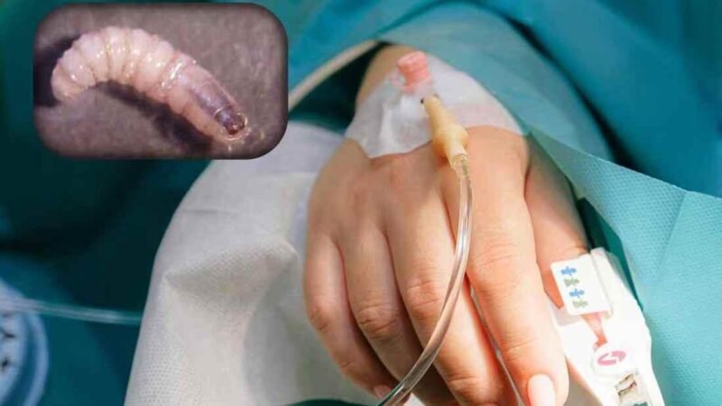 DETECTAN PERSONA INFECTADA POR GUSANO BARRENADOR EN YUCATÁN