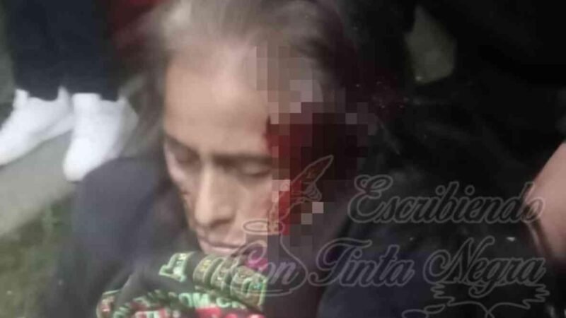 DROGADICTO GOLPEA A SENECTA EN XOCOTLA