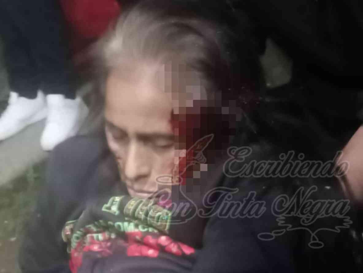 DROGADICTO GOLPEA A SENECTA EN XOCOTLA