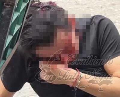 LE PROPINAN GOLPIZA A SUJETO EN HUATUSCO