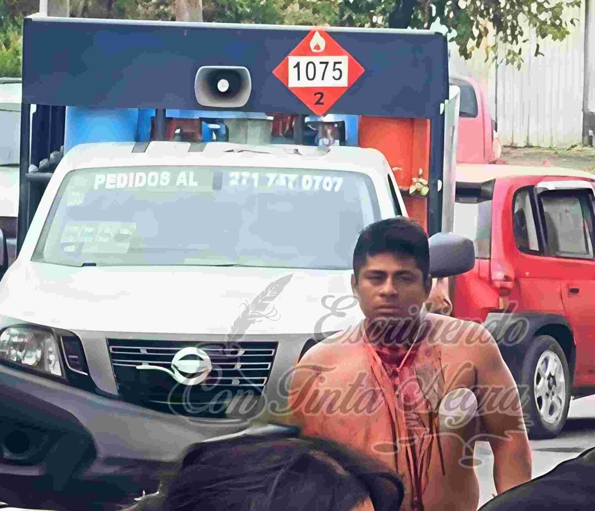 SUJETO SE AUTO LESIONA Y ATACA A LA POLICÍA