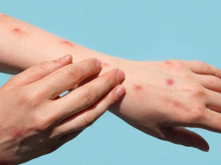 EN RIESGO, CERTIFICACIÓN CONTRA SARAMPIÓN EN MÉXICO