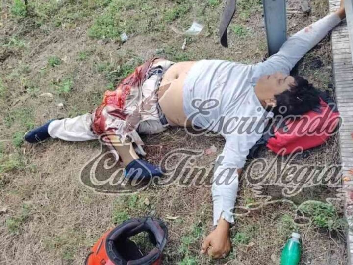 MOTOCICLISTA PIERDE UNA PIERNA EN ACCIDENTE