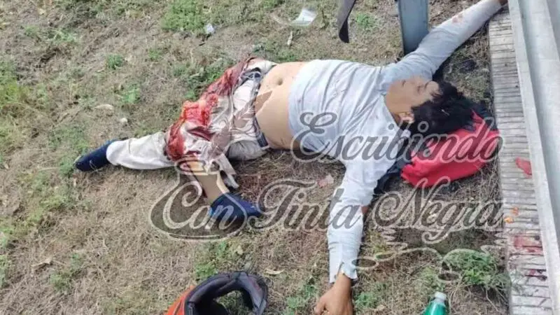 MOTOCICLISTA PIERDE UNA PIERNA EN ACCIDENTE