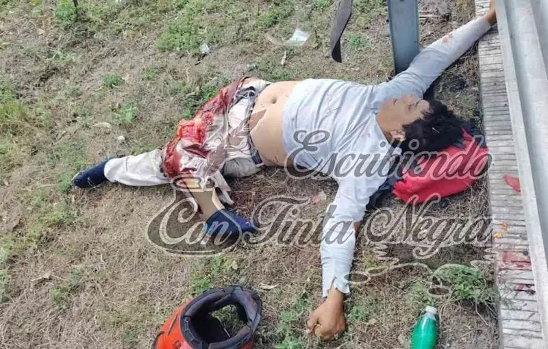 MOTOCICLISTA PIERDE UNA PIERNA EN ACCIDENTE