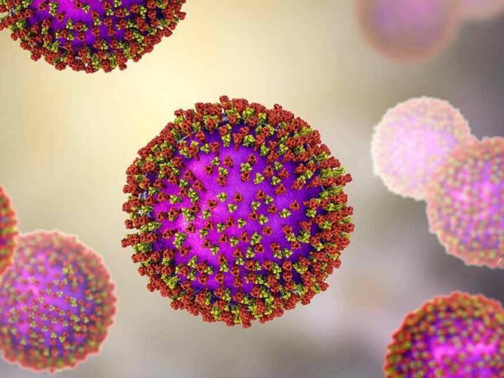 ESTADOS UNIDOS SUPERA LOS MIL 100 CASOS DE SARAMPIÓN