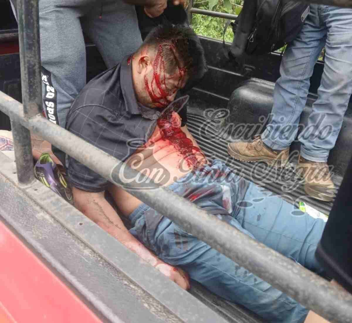 MUERE MOTOCICLISTA DE IXHUATLÁN DEL CAFÉ TRAS CHOQUE