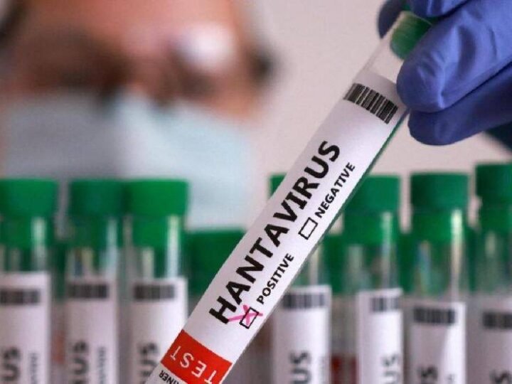 ISRAEL CONFIRMA SU PRIMER CASO DE HANTAVIRUS 