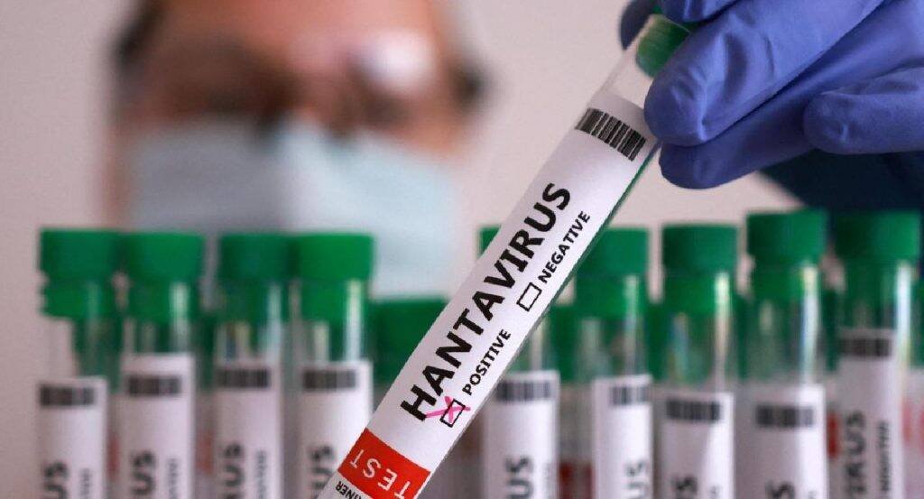 ISRAEL CONFIRMA SU PRIMER CASO DE HANTAVIRUS 