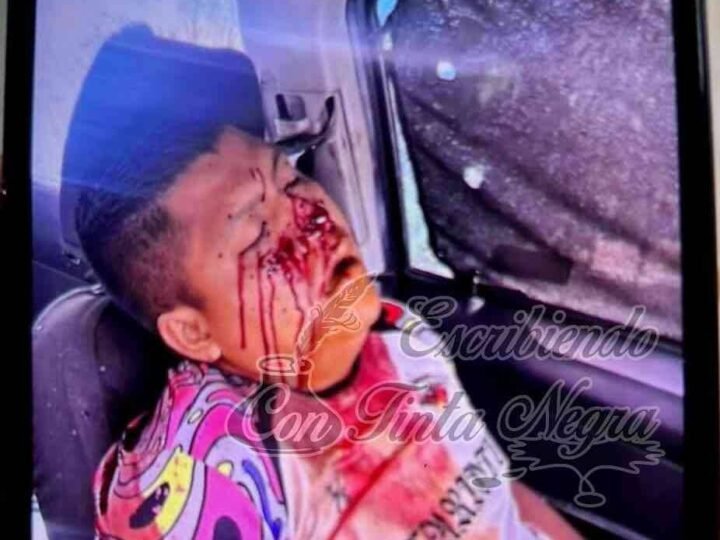 EJECUTAN A TAXISTA DE CUITLÁHUAC