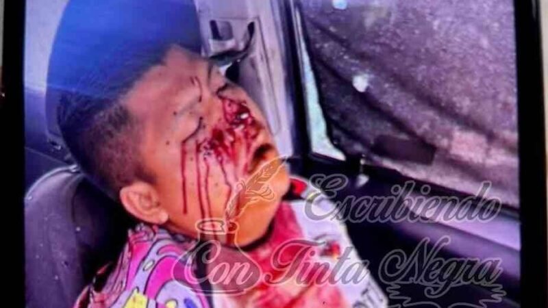 EJECUTAN A TAXISTA DE CUITLÁHUAC