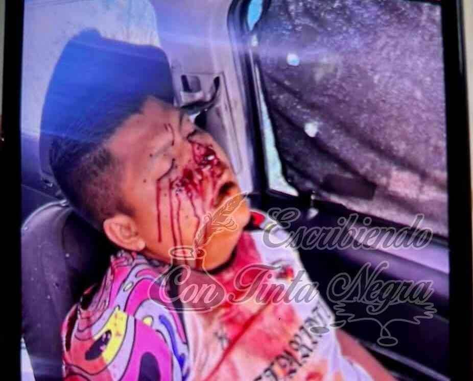 EJECUTAN A TAXISTA DE CUITLÁHUAC