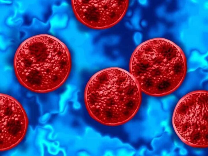 MÉXICO REPORTA TRES CASOS DE CYCLOSPORA