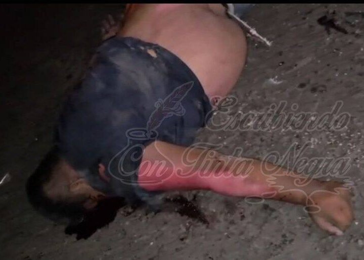 MUERE MOTOCICLISTA EN ACCIDENTE