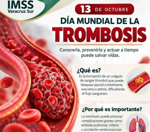 EXHORTA IMSS VERACRUZ SUR A DETECTAR SÍNTOMAS DE TROMBOSIS
