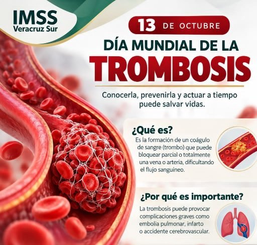 EXHORTA IMSS VERACRUZ SUR A DETECTAR SÍNTOMAS DE TROMBOSIS